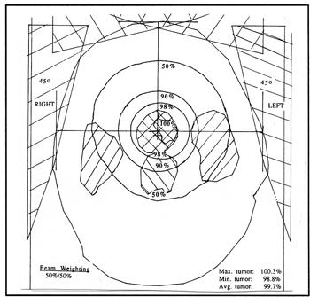 drawing isodoses for head rotation technique radiation therapy